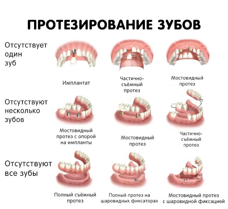 Обычно, когда мы говорим о протезах, в первую очередь думают о чем-то крупном, например руках или ногах
Но вообще протезы бывают самые разные, в том числе разных частей лица (например части челюсти ил... | Сетка — новая социальная сеть от hh.ru
