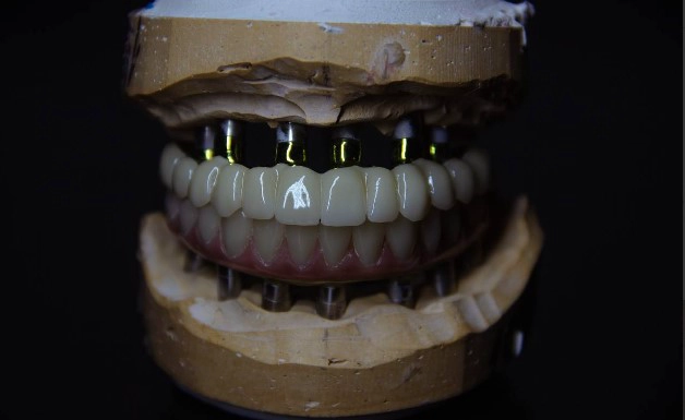 Профессиональное 3D-моделирование зубов | CAD/CAM
Предлагаю услуги по 3D-моделированию зубов для стоматологических клиник, зуботехнических лабораторий и частных специалистов | Сетка — новая социальная сеть от hh.ru