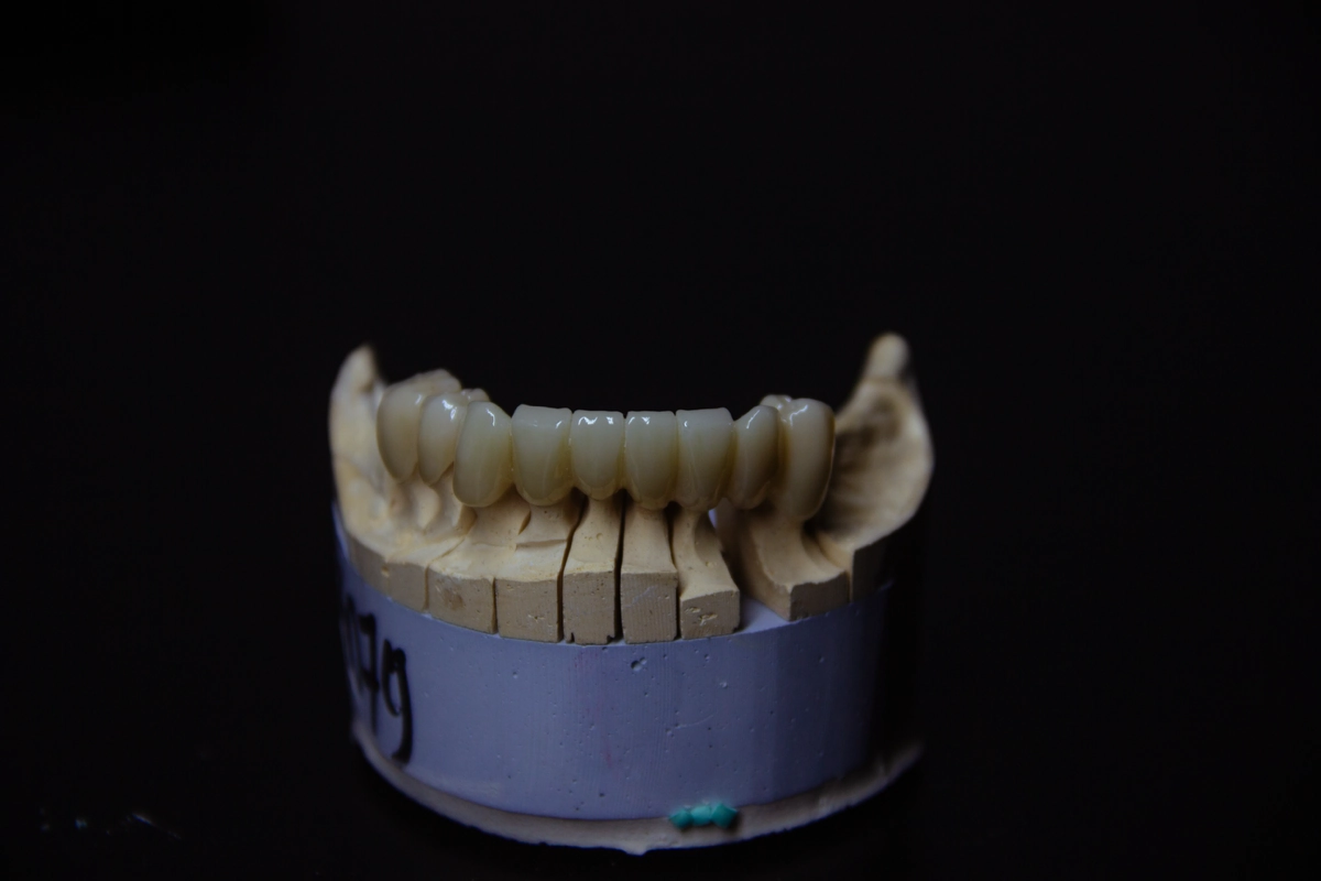 Профессиональное 3D-моделирование зубов | CAD/CAM
Предлагаю услуги по 3D-моделированию зубов для стоматологических клиник, зуботехнических лабораторий и частных специалистов | Сетка — новая социальная сеть от hh.ru