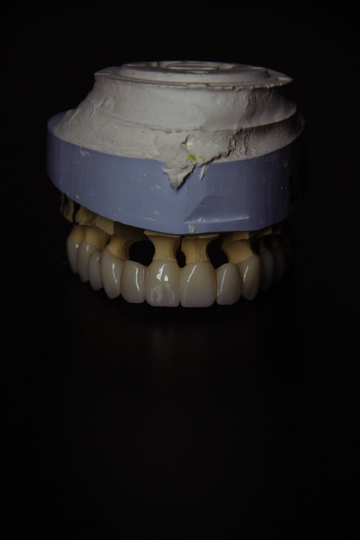 Профессиональное 3D-моделирование зубов | CAD/CAM
Предлагаю услуги по 3D-моделированию зубов для стоматологических клиник, зуботехнических лабораторий и частных специалистов | Сетка — новая социальная сеть от hh.ru